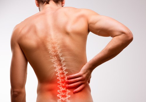 Man with herniated disc holding back
