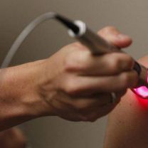 Chiropractor performing laser treatment