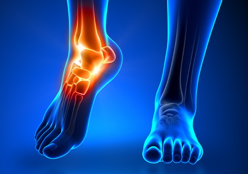 3 D rendering of patient experiencing foot pain